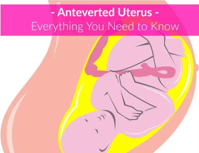 Anteverted Uterus