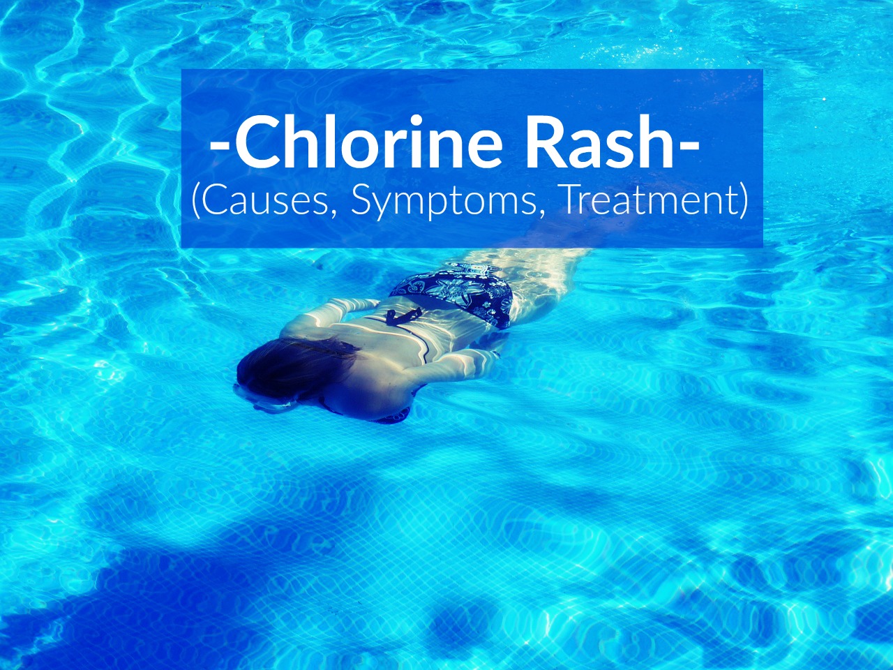 Chlorine Rash