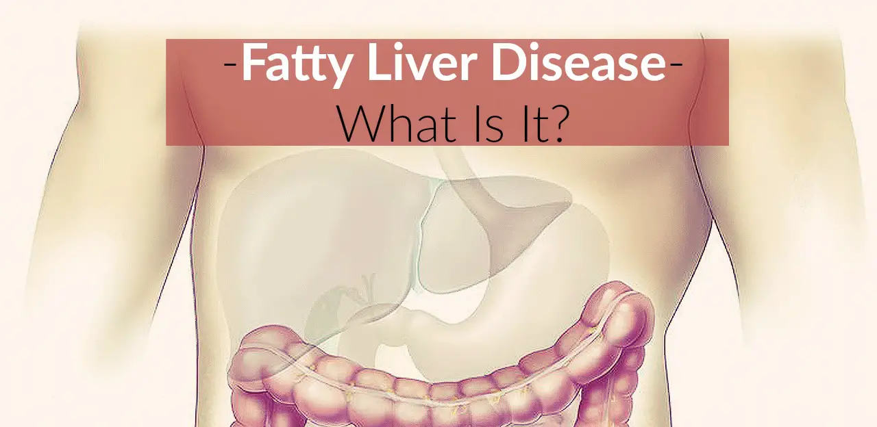 Fatty Liver Disease