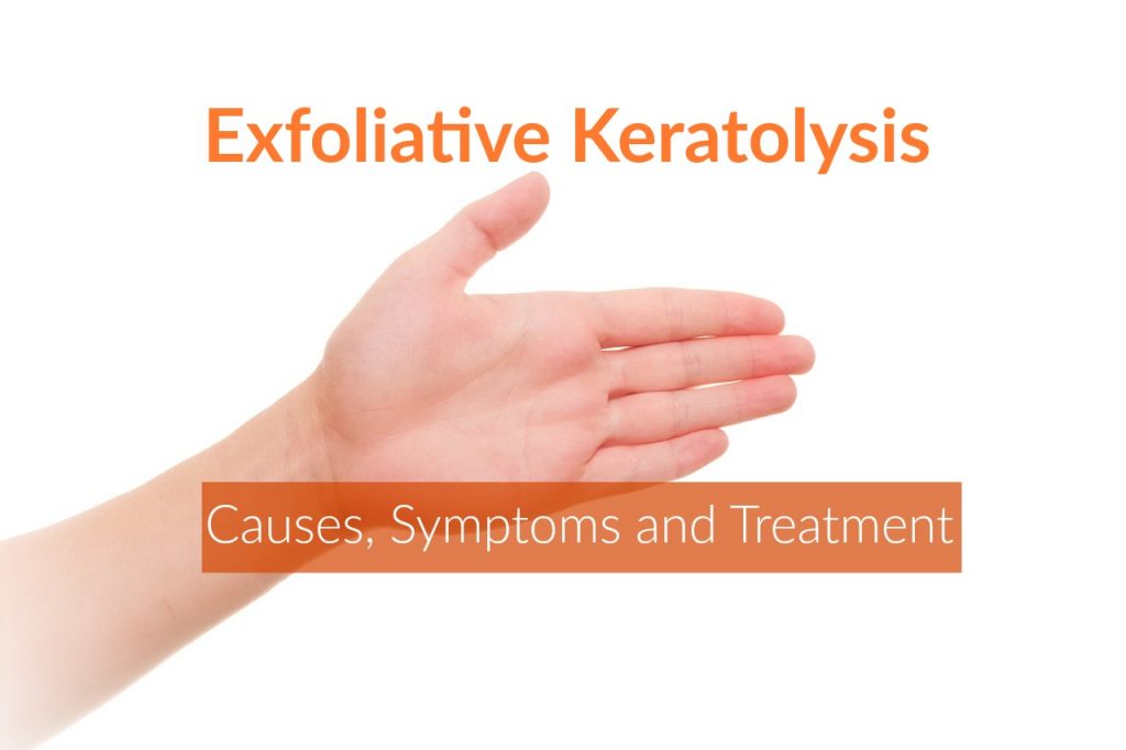 Exfoliative Keratolysis (Causes,Symptoms,Treatment) The Healthy Apron