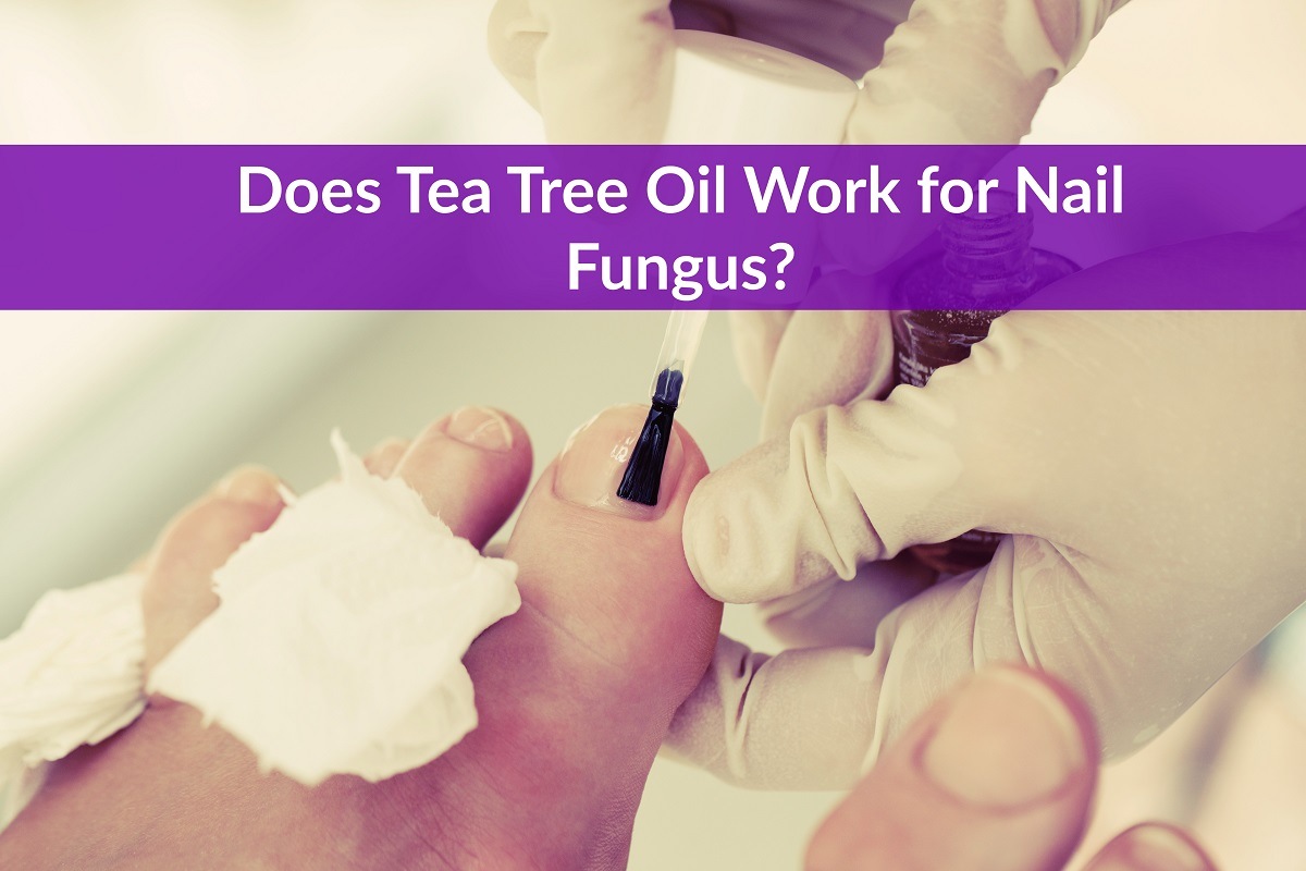 Does Tea Tree Oil Work For Nail Fungus The Healthy Apron