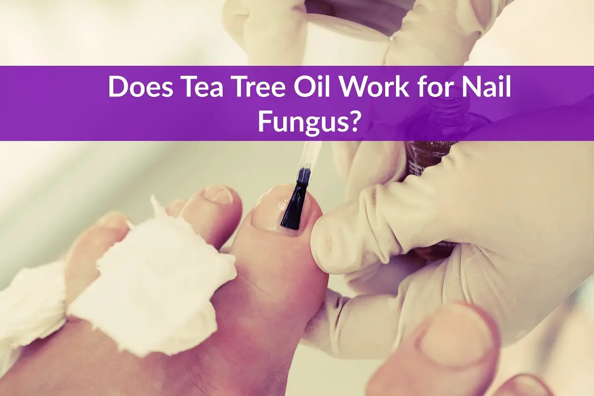 Does Tea Tree Oil Work For Nail Fungus The Healthy Apron