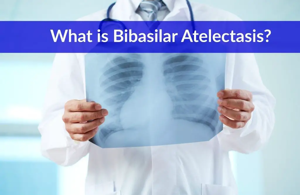 Bibasilar Atelectasis (Definition, Symptoms, Causes, Treatment) - The