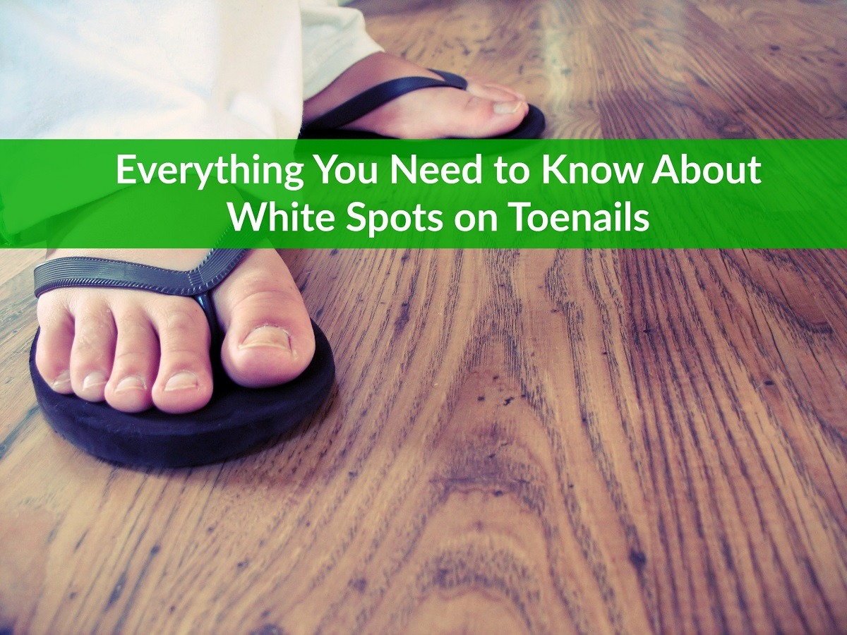 White Spots on Toenails