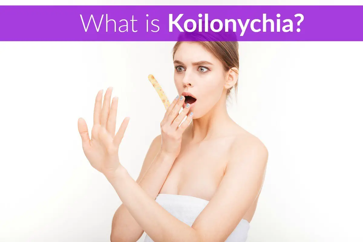 What is Koilonychia