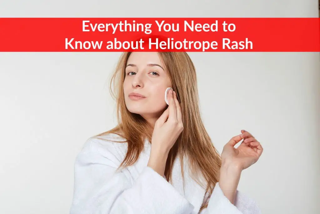 Heliotrope Rash - what can we do about it? - The Healthy Apron