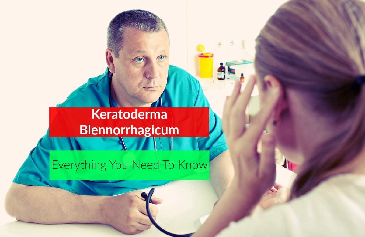 treatment Keratoderma Blennorrhagicum