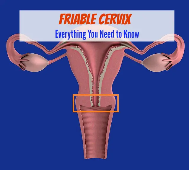 Friable Cervix - Everything You Need to Know