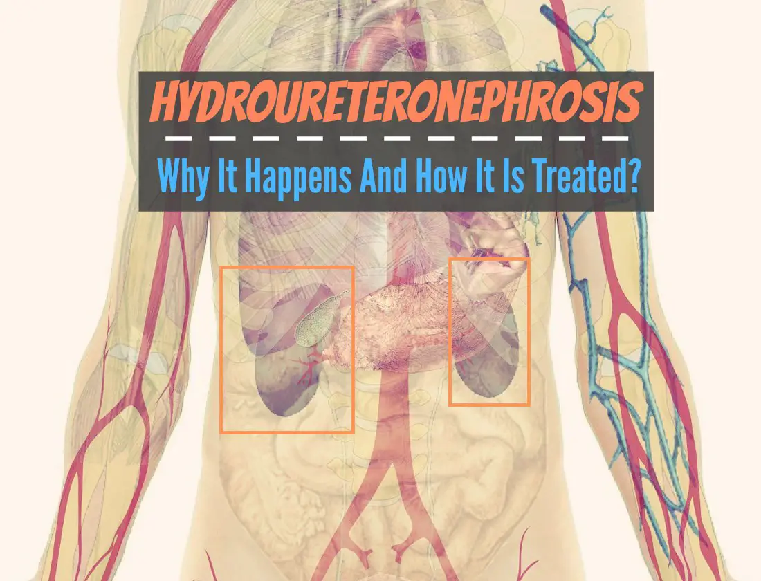Hydroureteronephrosis - Why It Happens