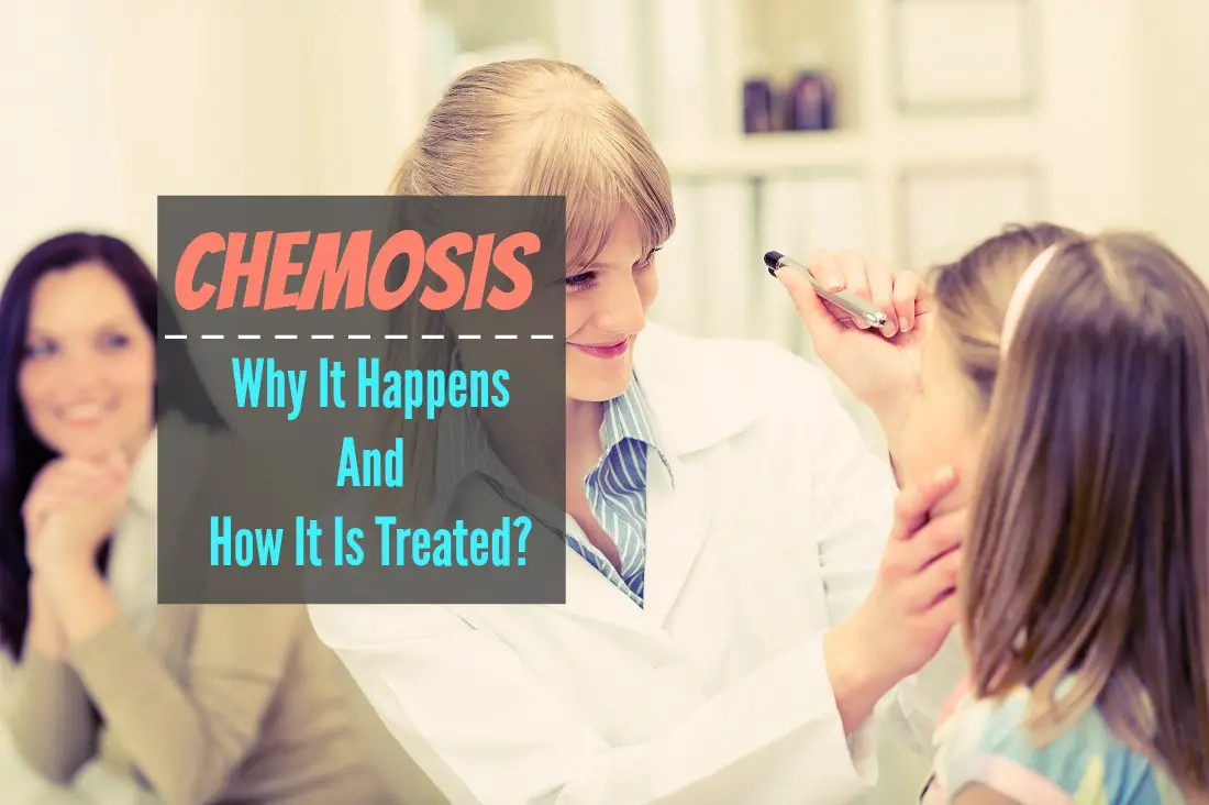 Chemosis Why It Happens And How It Is Treated