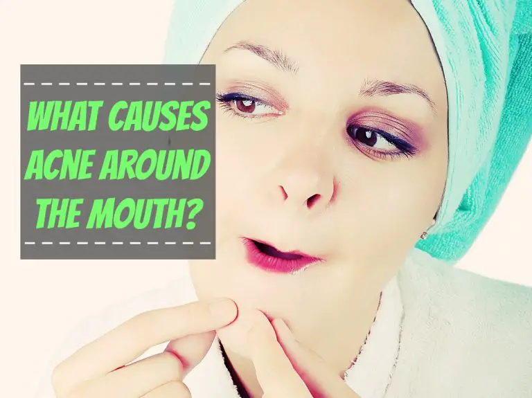 What Causes Acne Around the Mouth? The Healthy Apron