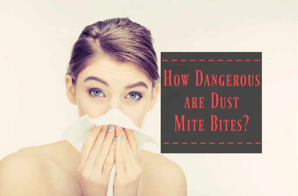 How Dangerous are Dust Mite Bites? When to See a Doctor? The Healthy Apron