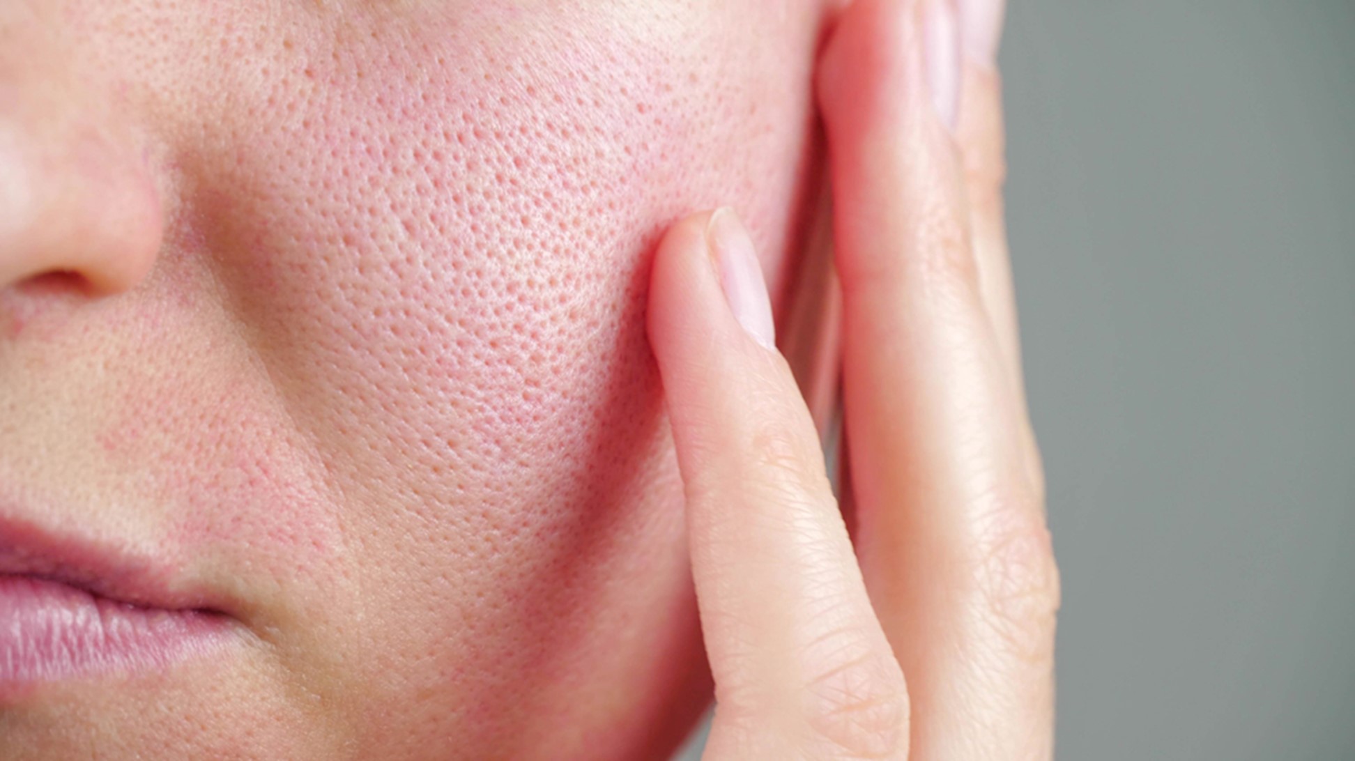 face pores